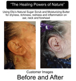 sugar scrub for dry skin