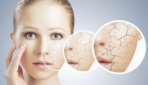 cold weather and dry skin